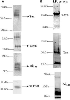 α-Synuclein Aggregated with Tau and β-Amyloid in Human Platelets from Healthy Subjects: Correlation with Physical Exercise
